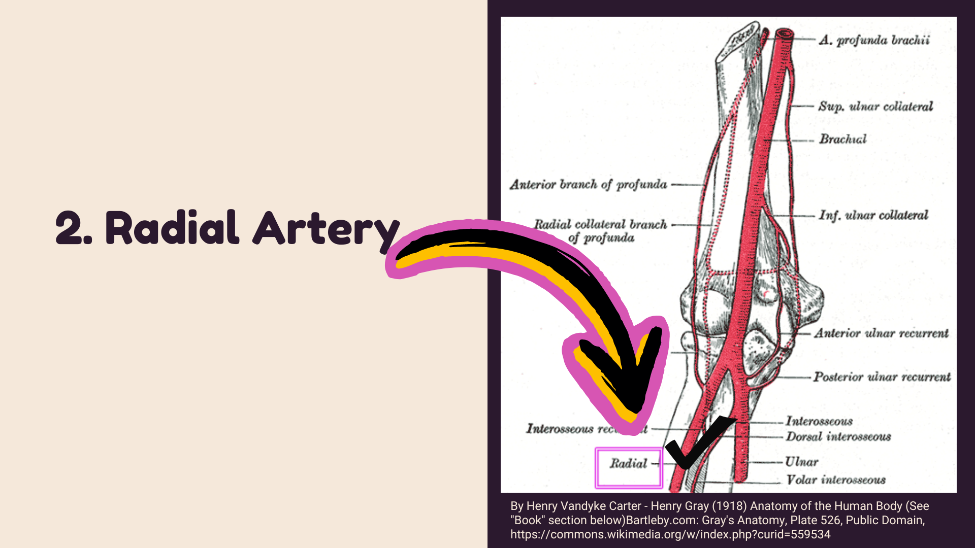 Anastomosis around the elbow joint | Upper limb Arteries | Upper limb